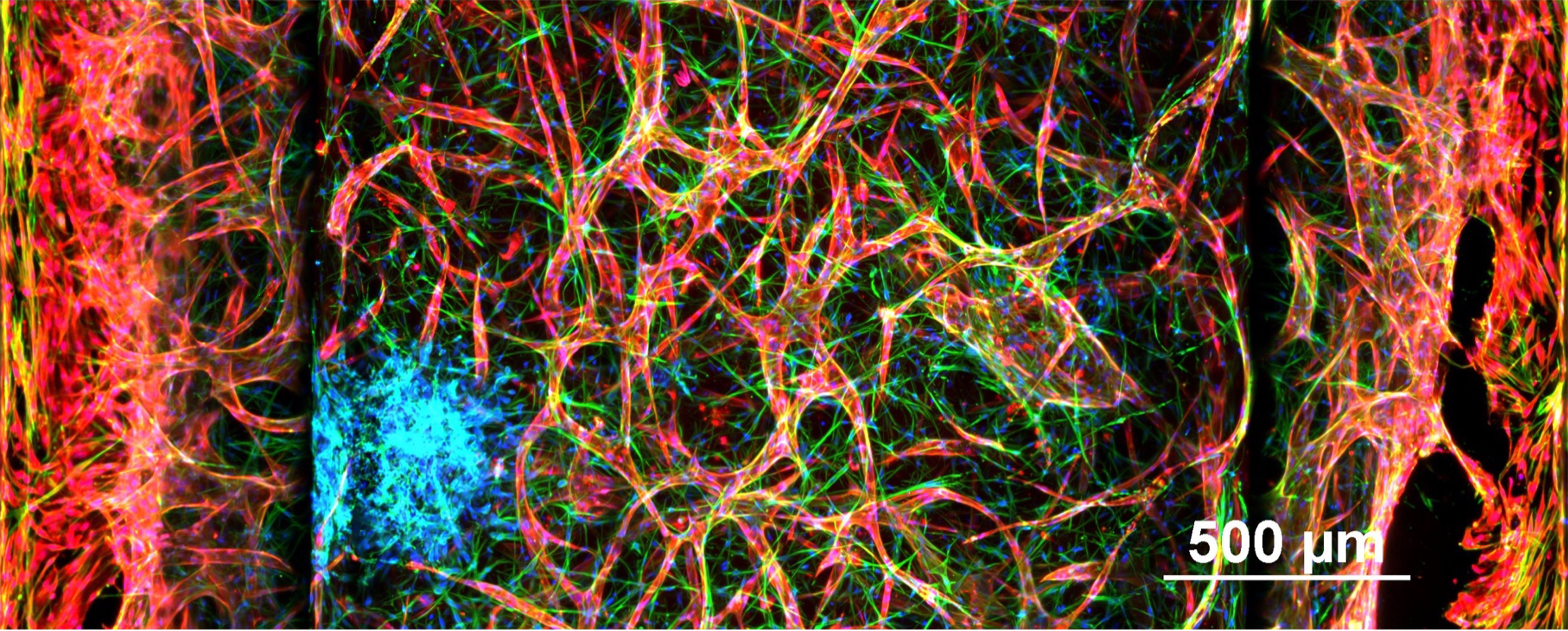 Microscopy graphic of a complex network of red, green, and blue filaments on a black background.