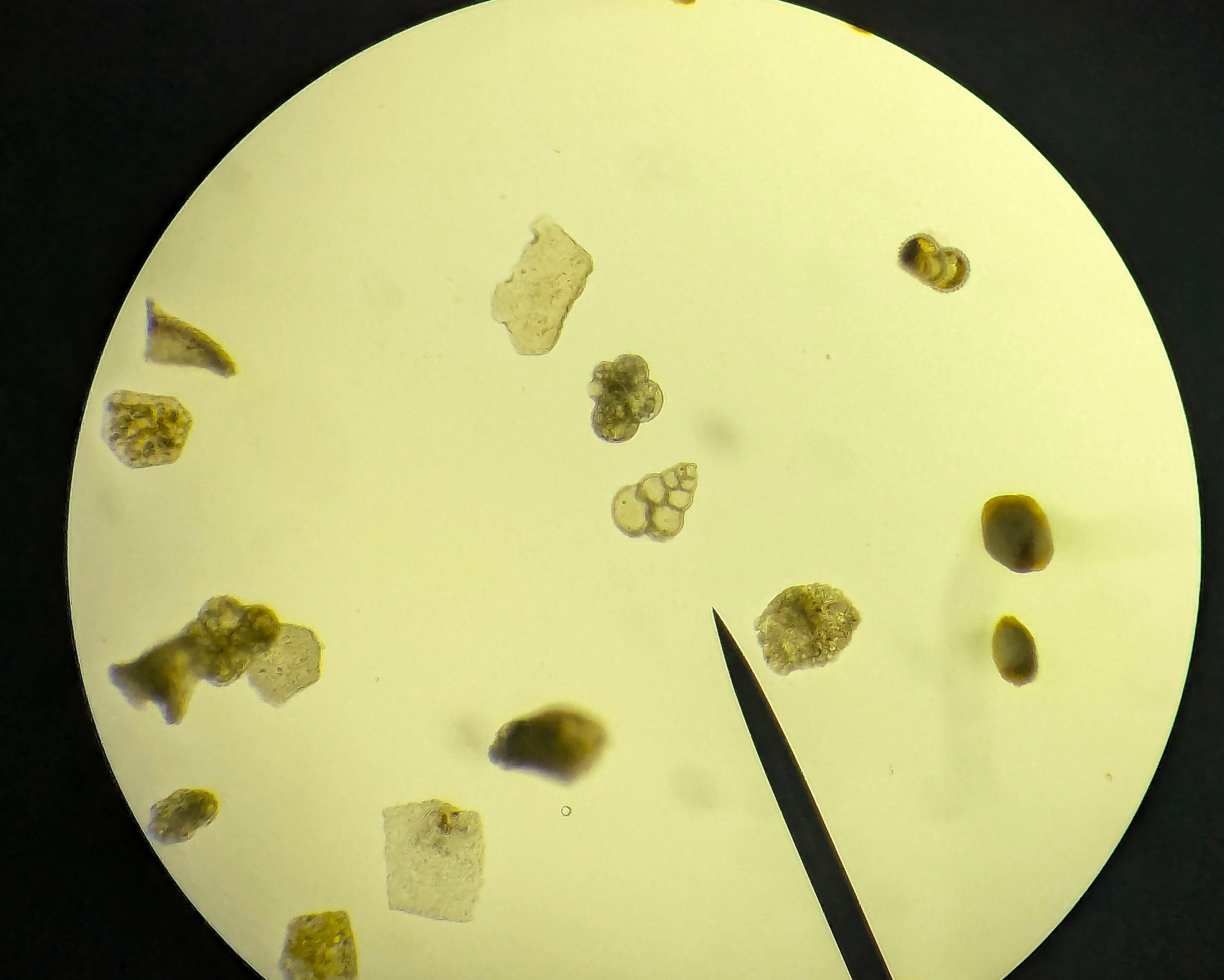 Microscope view of various cells and debris on a yellow slide.