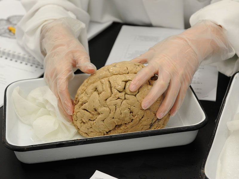 A gloved researcher gently holds a preserved human brain in a metal tray.
