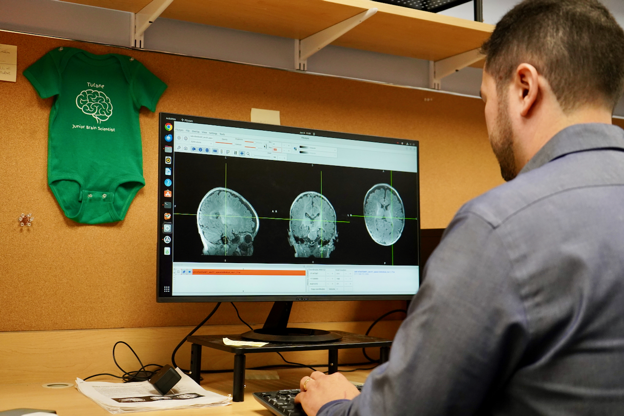 Photograph of a researcher viewing brain scans on a computer monitor.