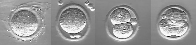 fertilization to 4-cell stage
