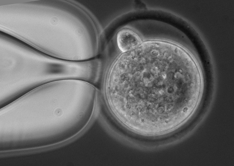 pronuclear stage mouse embryo